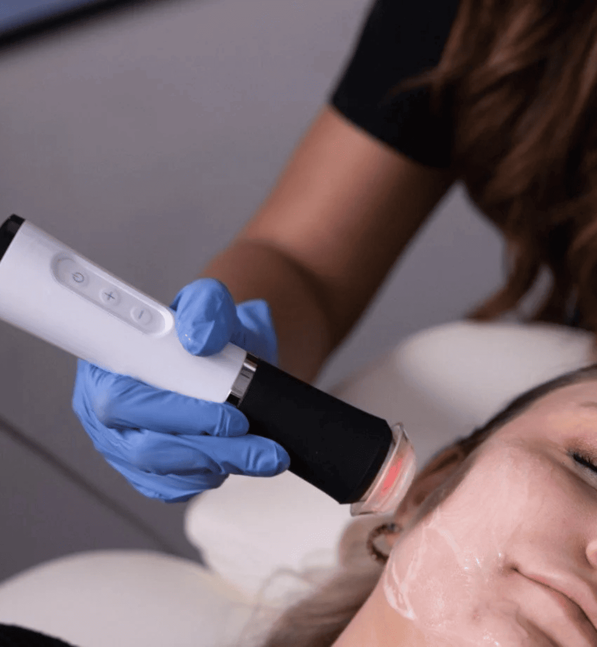 Stem Cell Facials for Skin Rejuvenation