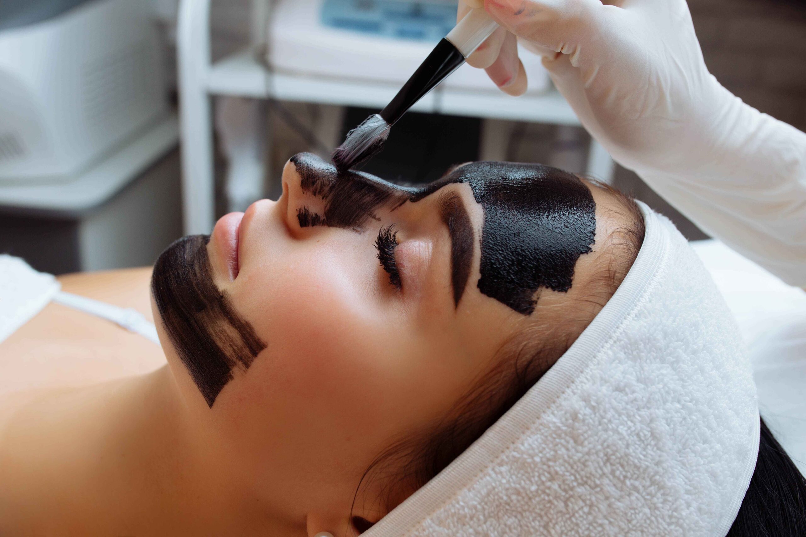 Chemical Peels for glowing skin